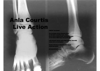 Anla Courtis Live Actions