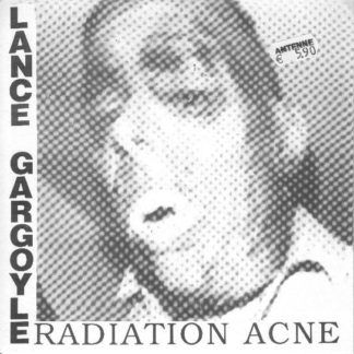 Lance Gargoyle Radiation Acne